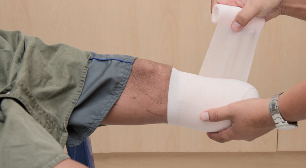 below knee stump bandaging, amputee BKA with prothesis preparing
